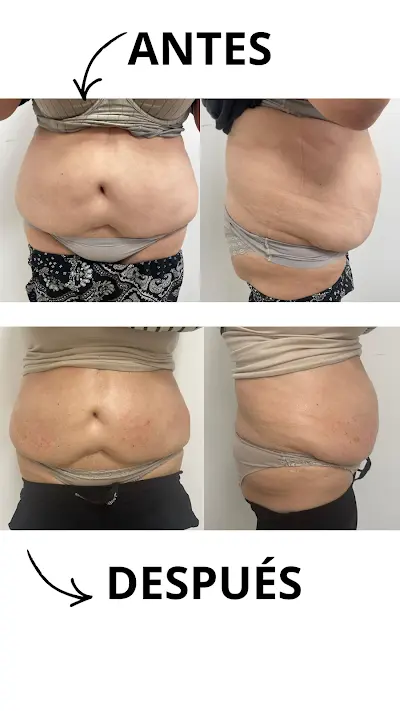 Más Que Belleza by Lorena Sánchez. Clínica Medico Estética Avanzada en Elda — Peluquería en Elda